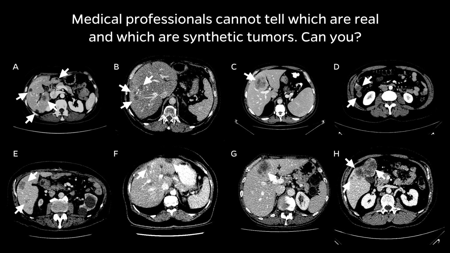 Scans of eight different tumors with the caption 